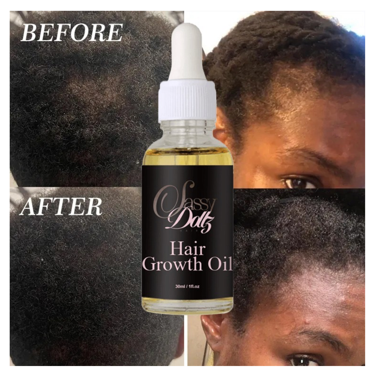 Sassy Dollz Hair Growth Oil