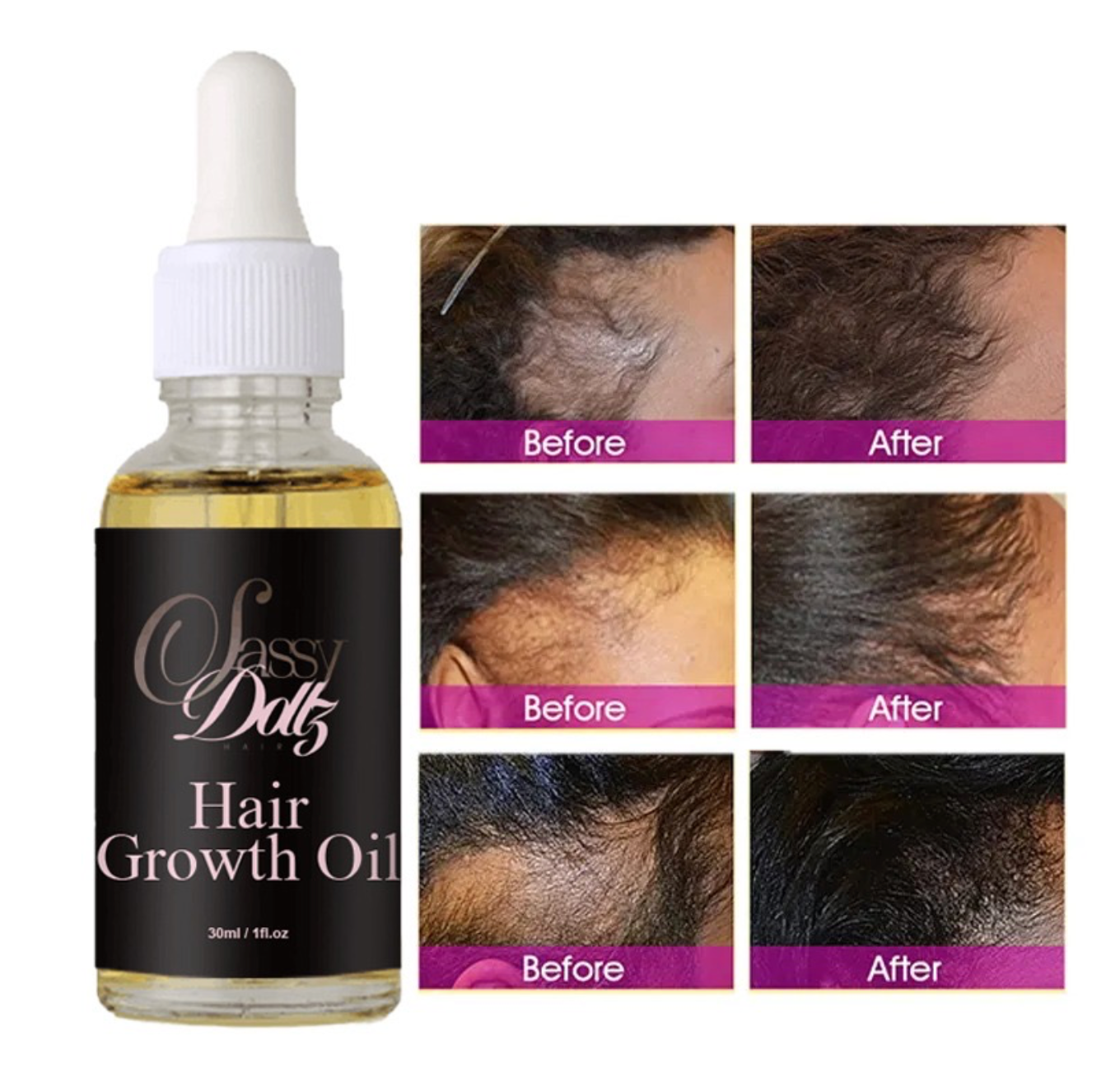 Sassy Dollz Hair Growth Oil