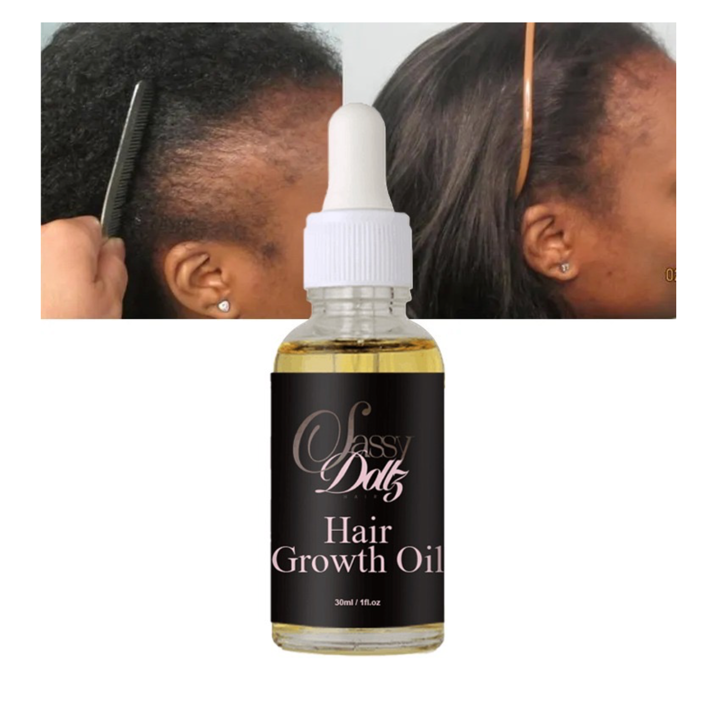 Sassy Dollz Hair Growth Oil