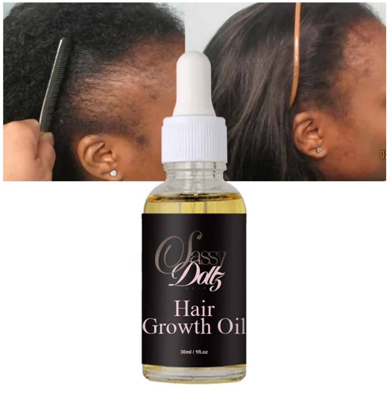 Sassy Dollz Hair Growth Oil